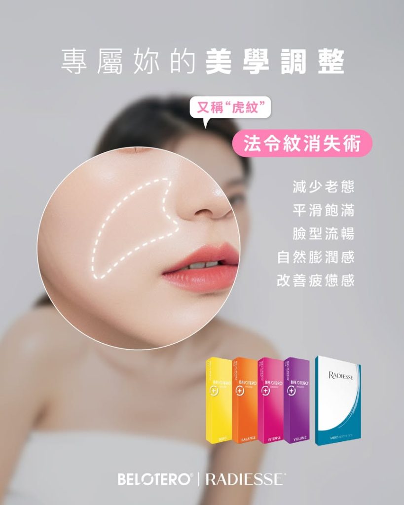 法令紋消失術